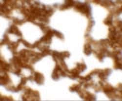 Invitrogen NETO1 Polyclonal Antibody 100 &mu;g; Unconjugated:Antibodies,