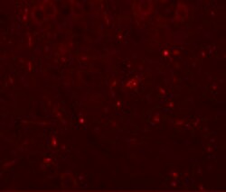 Invitrogen SEC62 Polyclonal Antibody 100 &mu;g | Buy Online | Invitrogen&trade; | Fisher Scientific