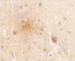 Invitrogen SEC62 Polyclonal Antibody 100 &mu;g | Buy Online | Invitrogen&trade; | Fisher Scientific