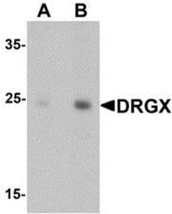 Invitrogen DRGX Polyclonal Antibody 100 &mu;g; Unconjugated:Antibodies,