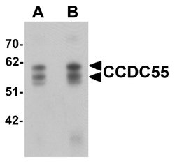 Invitrogen NSRP1 Polyclonal Antibody 100 &mu;g; Unconjugated:Antibodies,