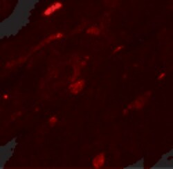 TGM5 Polyclonal Antibody:Antibodies, Polyclonal