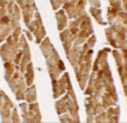 TGM5 Polyclonal Antibody:Antibodies, Polyclonal