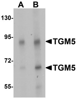 TGM5 Polyclonal Antibody:Antibodies, Polyclonal