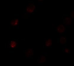 Invitrogen SLC35D3 Polyclonal Antibody 100 &mu;g; Unconjugated:Antibodies,