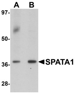 Invitrogen SPATA1 Polyclonal Antibody 100 &mu;g; Unconjugated:Antibodies,