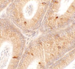 Invitrogen SPATA4 Polyclonal Antibody 100 &mu;g; Unconjugated:Antibodies,