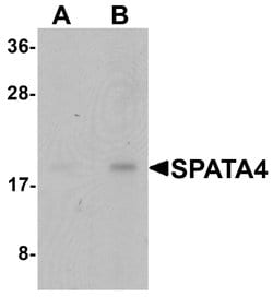 Invitrogen SPATA4 Polyclonal Antibody 100 &mu;g; Unconjugated:Antibodies,
