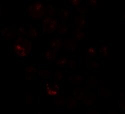 Invitrogen PRICKLE4 Polyclonal Antibody 100 &mu;g; Unconjugated:Antibodies,