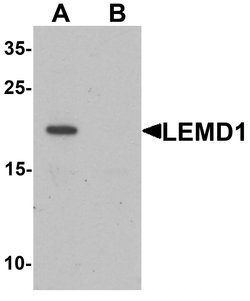 Invitrogen LEMD1 Polyclonal Antibody 100 &mu;g; Unconjugated:Antibodies,