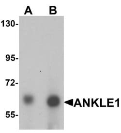 Invitrogen ANKLE1 Polyclonal Antibody 100 &mu;g; Unconjugated:Antibodies,
