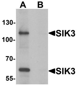 Invitrogen SIK3 Polyclonal Antibody 100 &mu;g; Unconjugated:Antibodies,