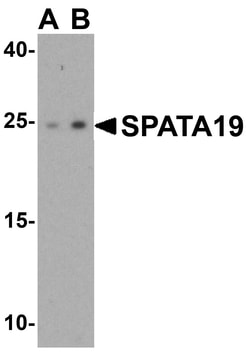 SPATA19 Polyclonal Antibody:Antibodies, Polyclonal