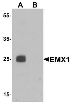 Invitrogen EMX1 Polyclonal Antibody 100 &mu;g; Unconjugated:Antibodies,
