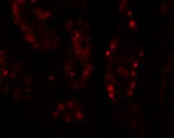 Invitrogen DISP1 Polyclonal Antibody 100 &mu;g; Unconjugated:Antibodies,