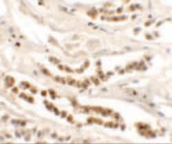 Invitrogen DISP1 Polyclonal Antibody 100 &mu;g; Unconjugated:Antibodies,