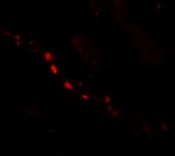 Invitrogen PTCHD2 Polyclonal Antibody 100 &mu;g; Unconjugated:Antibodies,
