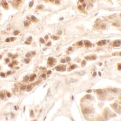 Invitrogen PTCHD2 Polyclonal Antibody 100 &mu;g; Unconjugated:Antibodies,