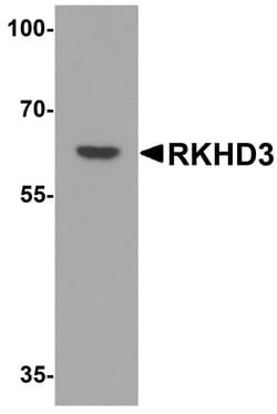 Invitrogen MEX3B Polyclonal Antibody 100 &mu;g; Unconjugated:Antibodies,