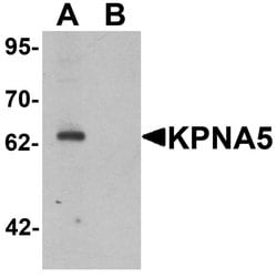 KPNA5 Polyclonal Antibody:Antibodies, Polyclonal