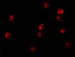 Invitrogen JMJD3 Polyclonal Antibody 100 &mu;g | Buy Online | Invitrogen&trade; | Fisher Scientific