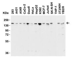 Invitrogen JMJD3 Polyclonal Antibody 100 &mu;g | Buy Online | Invitrogen&trade; | Fisher Scientific