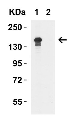Invitrogen JMJD3 Polyclonal Antibody 100 &mu;g | Buy Online | Invitrogen&trade; | Fisher Scientific