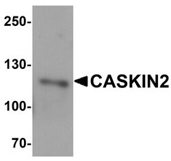 Invitrogen CASKIN2 Polyclonal Antibody 100 &mu;g; Unconjugated:Antibodies,