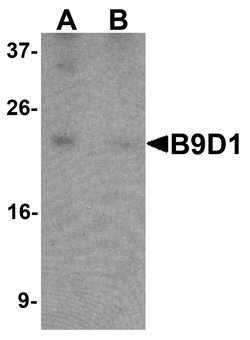 Invitrogen B9D1 Polyclonal Antibody 100 &mu;g; Unconjugated:Antibodies,
