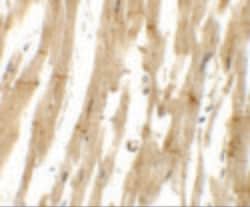 Invitrogen MLIP Polyclonal Antibody 100 &mu;g; Unconjugated:Antibodies,