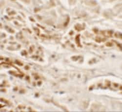 Invitrogen Nkx2.2 Polyclonal Antibody 100 &mu;g; Unconjugated:Antibodies
