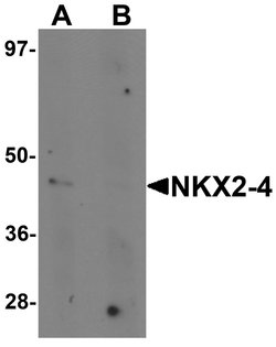 Invitrogen Nkx2.4 Polyclonal Antibody 100 &mu;g; Unconjugated:Antibodies,