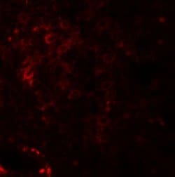 Invitrogen Nkx2.6 Polyclonal Antibody 100 &mu;g; Unconjugated:Antibodies,