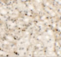 Invitrogen Nkx2.6 Polyclonal Antibody 100 &mu;g; Unconjugated:Antibodies,