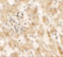 Invitrogen Nkx2.8 Polyclonal Antibody 100 &mu;g; Unconjugated:Antibodies,