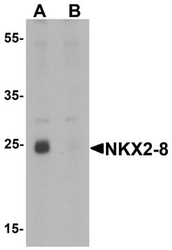 Invitrogen Nkx2.8 Polyclonal Antibody 100 &mu;g; Unconjugated:Antibodies,