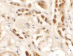 Invitrogen&trade;&nbsp;SIGLEC15 Polyclonal Antibody