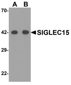 Invitrogen SIGLEC15 Polyclonal Antibody 100 &mu;g | Buy Online | Invitrogen&trade; | Fisher Scientific
