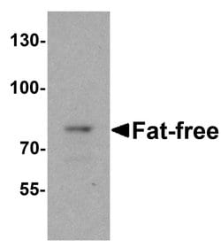 Invitrogen VPS51 Polyclonal Antibody 100 &mu;g | Buy Online | Invitrogen&trade; | Fisher Scientific