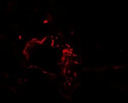 Invitrogen ACSL1 Polyclonal Antibody 100 &mu;g; Unconjugated:Antibodies,