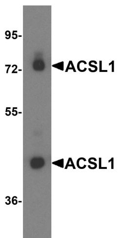 Invitrogen ACSL1 Polyclonal Antibody 100 &mu;g; Unconjugated:Antibodies,