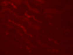 Invitrogen Kallikrein 4 Polyclonal Antibody 100 &mu;g; Unconjugated:Antibodies,