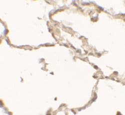 Invitrogen DOPA Decarboxylase Polyclonal Antibody 100 &mu;g; Unconjugated:Antibodies,