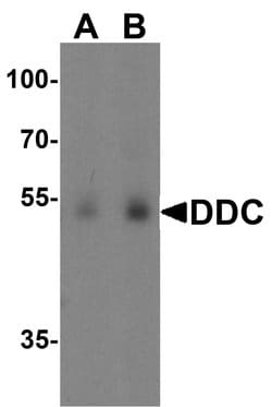 Invitrogen DOPA Decarboxylase Polyclonal Antibody 100 &mu;g; Unconjugated:Antibodies,