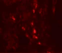 Invitrogen Arylsulfatase B Polyclonal Antibody 100 &mu;g | Buy Online | Invitrogen&trade; | Fisher Scientific