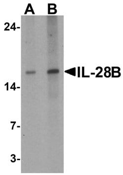 Invitrogen IL-28B Polyclonal Antibody 100 &mu;g; Unconjugated:Antibodies,