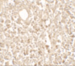 Invitrogen TMEM107 Polyclonal Antibody 100 &mu;g; Unconjugated:Antibodies,