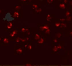 Invitrogen PHF14 Polyclonal Antibody 100 &mu;g | Buy Online | Invitrogen&trade; | Fisher Scientific