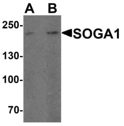 Invitrogen SOGA1 Polyclonal Antibody 100 &mu;g; Unconjugated:Antibodies,