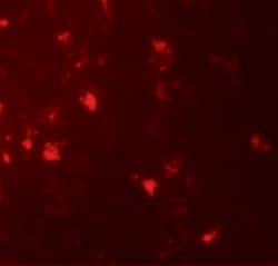 Invitrogen IL1F6 Polyclonal Antibody 100 &mu;g; Unconjugated:Antibodies,